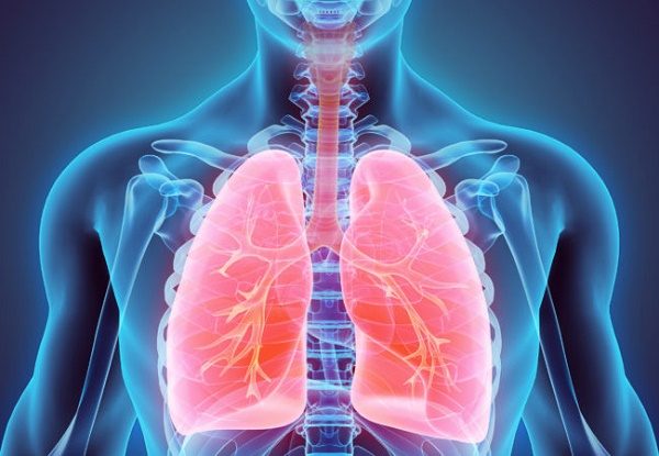 Bệnh xơ nang phổi là gì