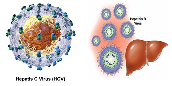 Virut viêm gan C là nguyên nhân gây viêm gan C