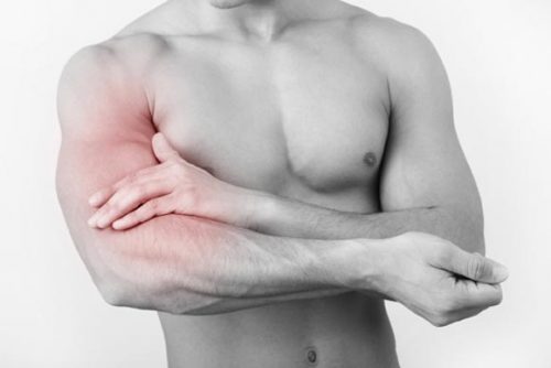 Các bệnh Viêm Cơ Chi Trên thường gặp - Dấu hiệu nhận biết & điều trị 2 Các bệnh viêm cơ chi trên thường gặp