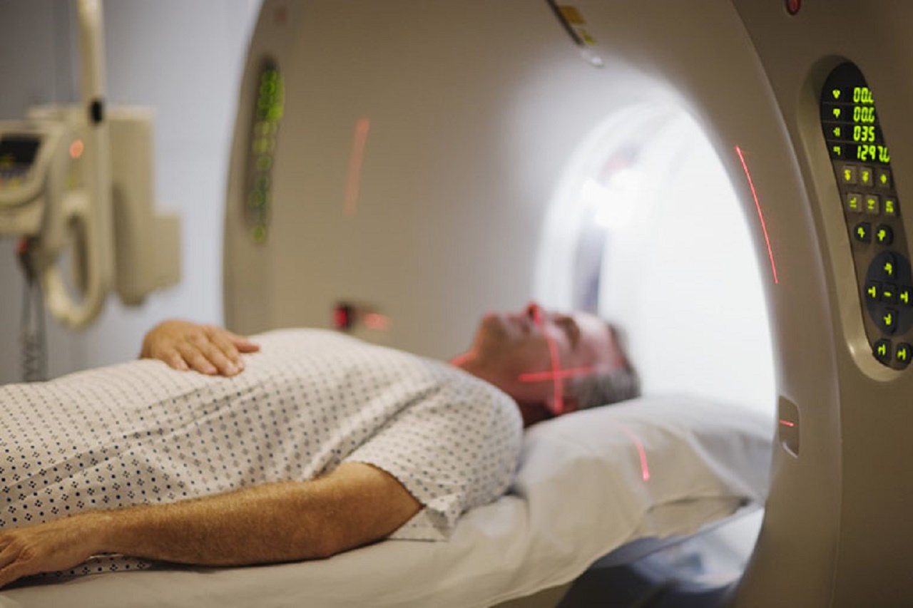 CT Scan sọ não là xét nghiệm nào và nó được sử dụng như thế nào trong việc phát hiện thiếu máu não?
