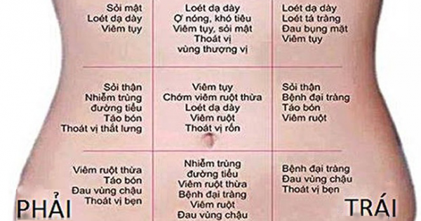 9 Vị Trí Đau Cảnh Báo Bệnh Nguy Hiểm - Những Dấu Hiệu Không Nên Bỏ Qua