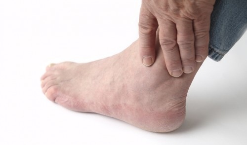 Mắt cá chân là vị trí phức tạp trên cơ thể vì có nhiều khớp nhỏ. đau khớp mắt cá chân bị fun88 app gì