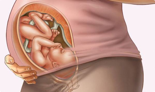 Đau xương chậu không gây nguy hiểm cho thai nhi nhưng khiến mẹ bầu mệt mỏi