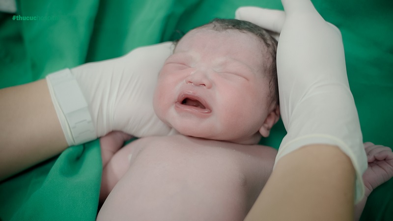Sau khi sinh, bé được bác sĩ Nhi - Bệnh viện Thu cúc kiểm tra sức khỏe sơ bộ, đánh giá các phản xạ đầu đời để đảm bảo bé hoàn toàn khỏe mạnh.