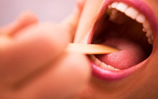 Tìm hiểu những cách chữa viêm họng hạt mãn tính hiện nay