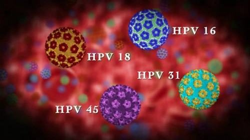 Ung thư hậu môn có liên quan tới virus HPV - đây là loại virus gây ung thư cổ tử cung ở nữ.