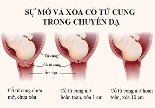 Khám xóa mở cổ tử cung | TCI Hospital