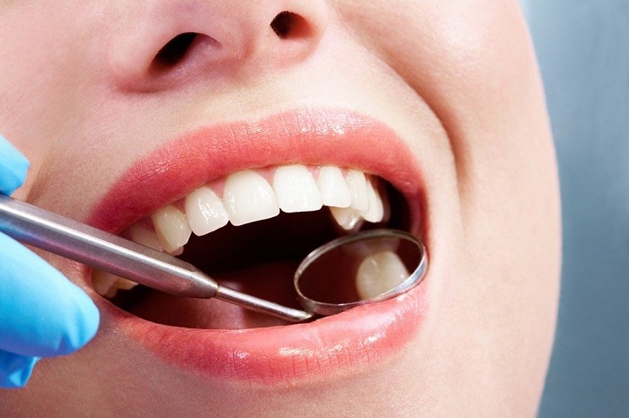 Dấu hiệu và triệu chứng nào cho thấy bầu 5 tháng cần nhổ răng?

