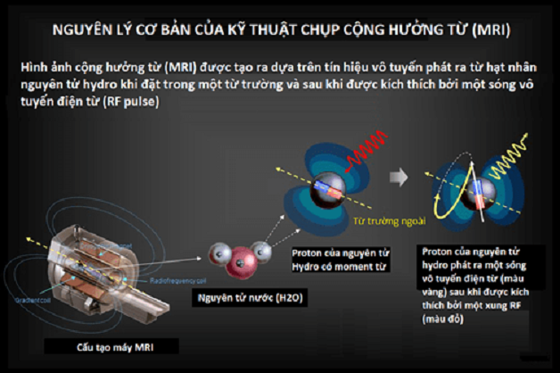 nguyên lý máy chụp mri