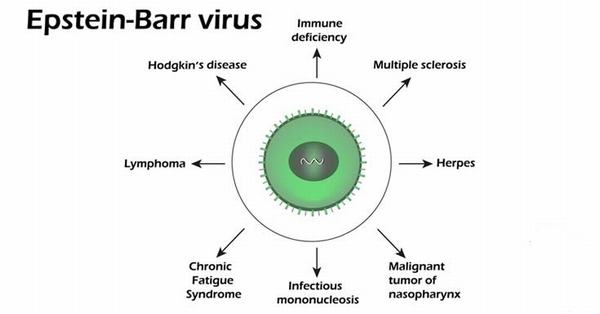 Virus EBV khá phổ biến, chúng có mặt ở khắp mọi nơi và có tới 90% dân số nhiễm loại virus này ở dạng không gây nhiễm trùng.