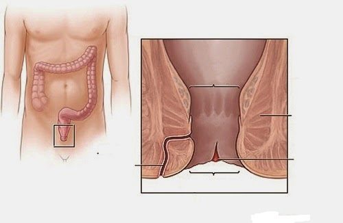 Tác động của nứt hậu môn tới sức khỏe?
