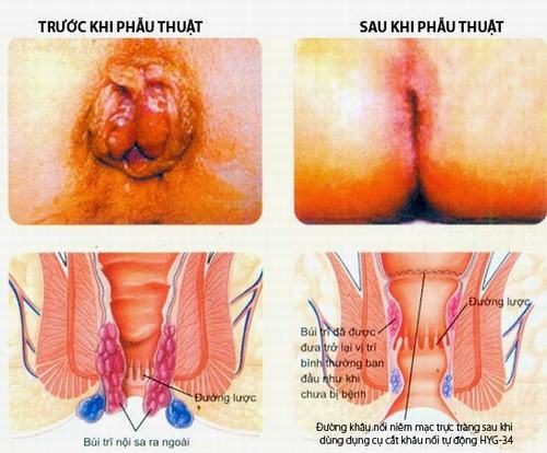 Phẫu Thuật Có Đau Không? Tất Tần Tật Thông Tin Cần Biết