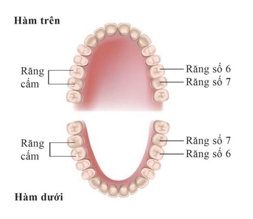 Răng Cấm Lung Lay Có Nên Nhổ? Giải Pháp Và Những Điều Cần Biết