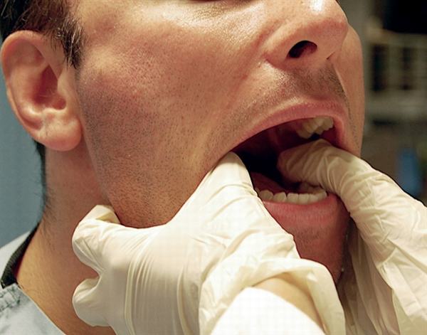 Há miệng quá to là một trong những nguyên nhân gây sái quai hàm