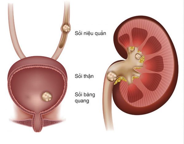 soi nieu quan co tan duoc khong 1