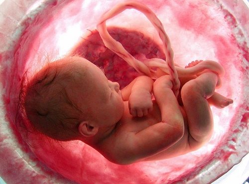 Trẻ được sinh ra với dây rốn gắn ở bụng