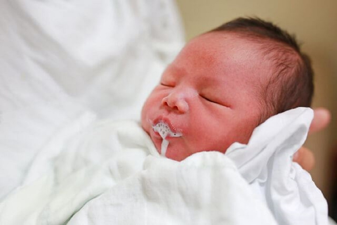 Почему ребенок 2 месяцев срыгивает. Срыгивание у новорожденных. Галактоземия фото новорожденного. Рвота и срыгивание у грудничка. Срыгивает новорожденный.