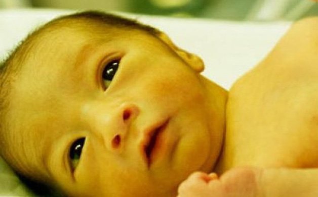Da, lòng bàn tay hoặc lòng bàn chân của trẻ không hồng hào, có màu vàng là dấu hiệu điển hình của trẻ sơ sinh bị vàng da.