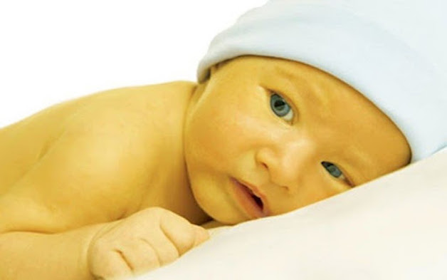 Da trẻ sơ sinh có màu vàng là do lượng sắc tố bilirubin trong máu cao.