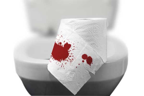 Máu thường màu đỏ tươi, loang thành vệt trên khuôn phân hay thấy ở giấy vệ sinh khi đi ngoài
