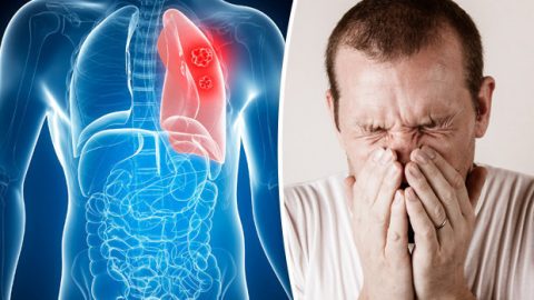 Triệu chứng u phổi lành tính