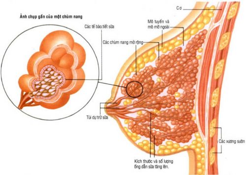 Tổng quan về Đa Nang Tuyến Vú