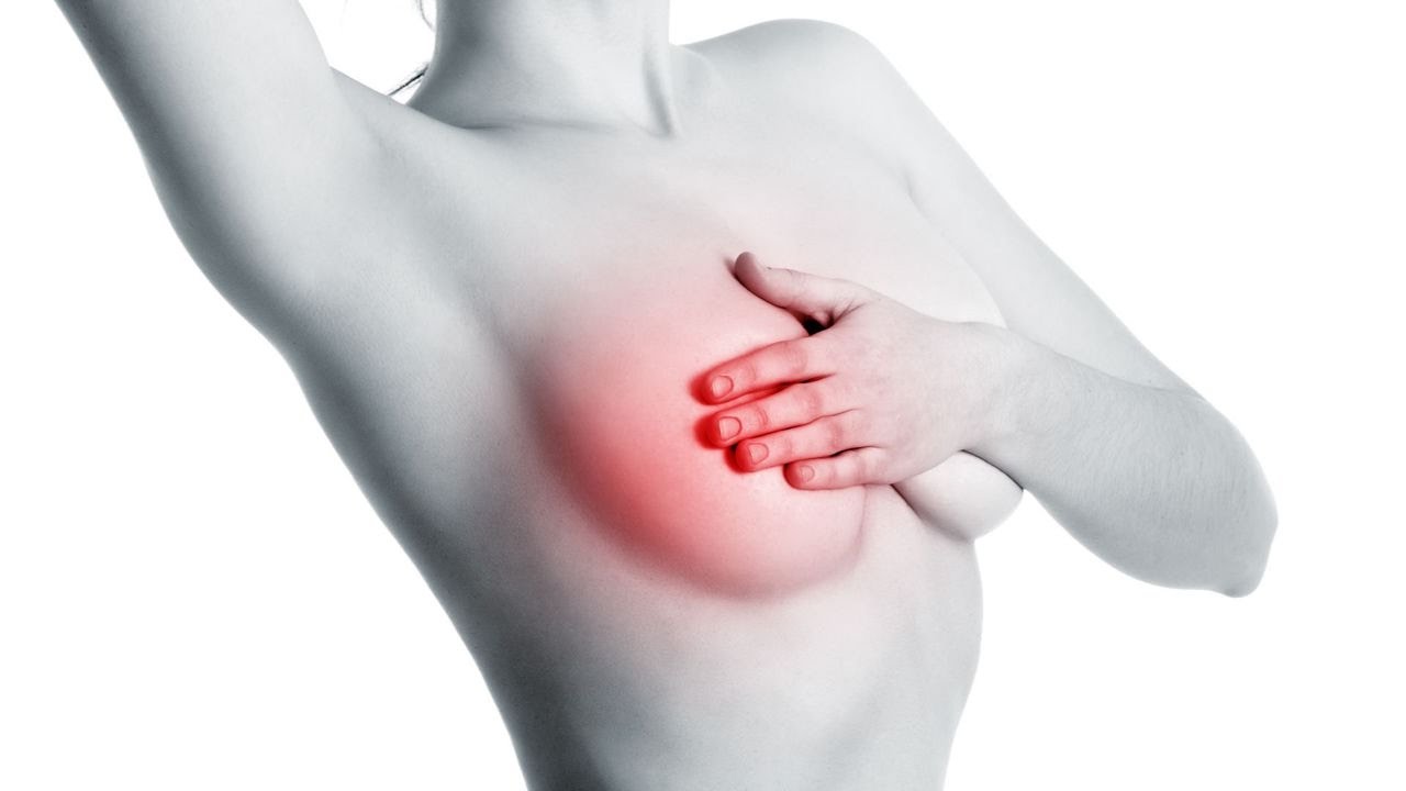 Các triệu chứng và dấu hiệu của u xơ ngực là gì?
