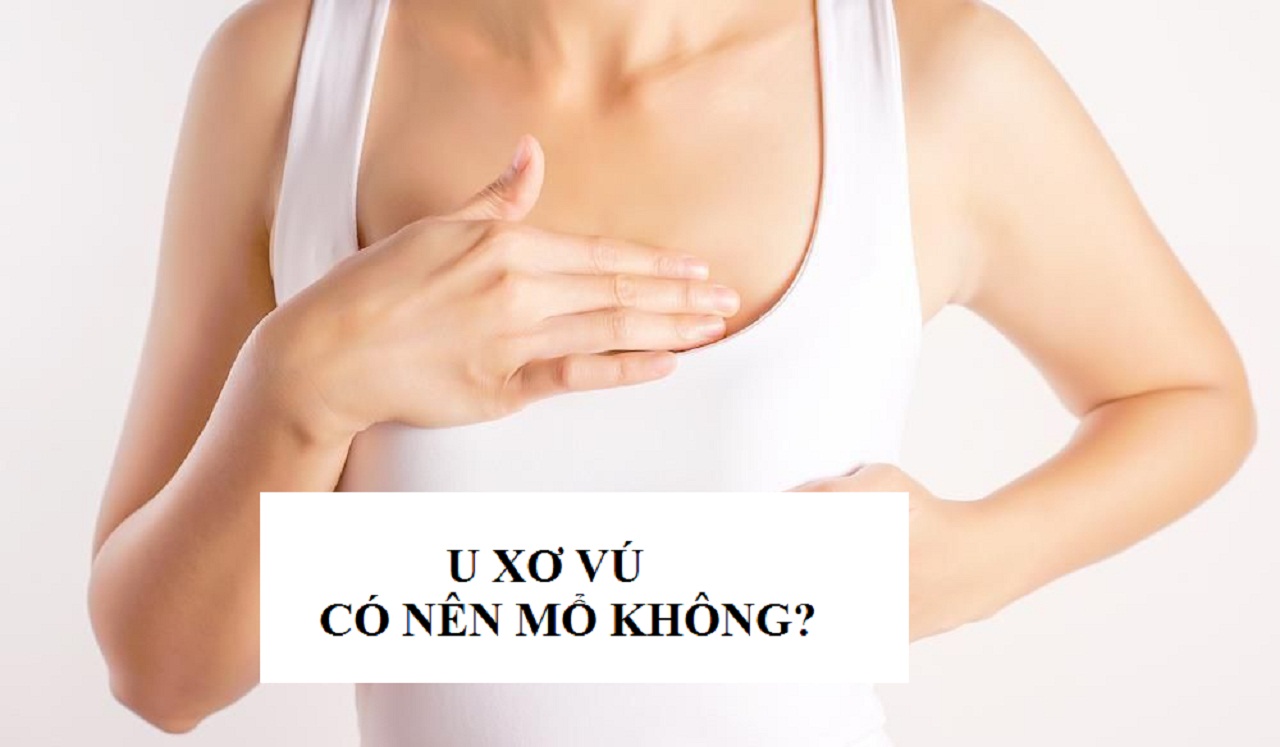 Khi nào cần phải mổ khối u lành tính?
