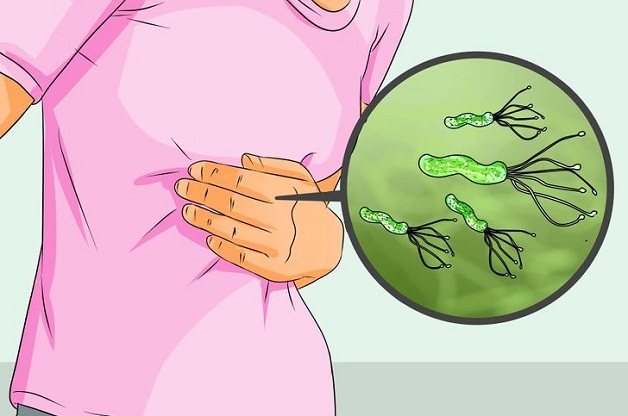 Vi khuẩn H pylori  gây viêm loét dạ dày