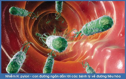 Vi khuẩn HP có thể tồn tại lâu trong dạ dày và gây bệnh