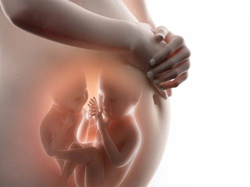 Sinh đôi là hiện tượng một phụ nữ mang thai đôi trong cùng 1 quá trình mang thai