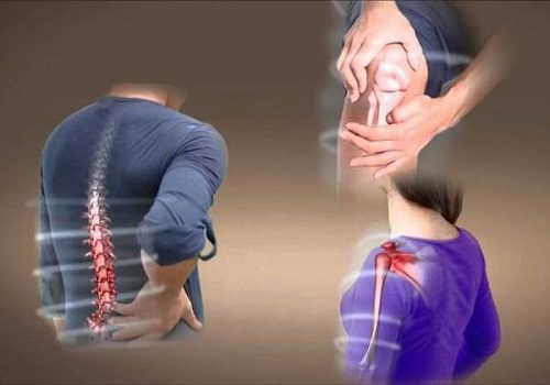 Viêm Cơ Cốt Hóa là gì? Nguyên nhân gây bệnh và Cách điều trị 3 Khi chụp X-quang sẽ phát hiện các khối sụn, xương bất thường trong mô