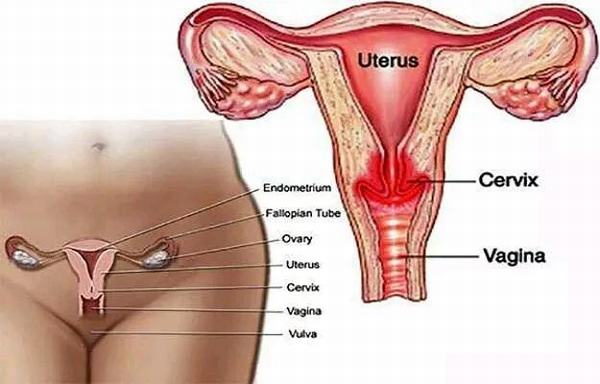 Viêm cổ tử cung là bệnh phụ khoa thường gặp ở nữ giới trong độ tuổi sinh sản. 