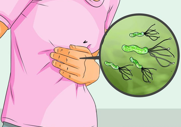 Đau bụng, là một trong những biểu hiện bệnh nhân viêm dạ dày mạn tính thường gặp