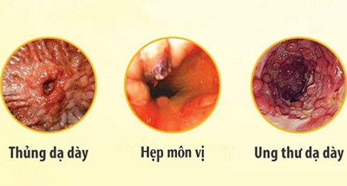 4. Chẩn đoán và các phương pháp xét nghiệm