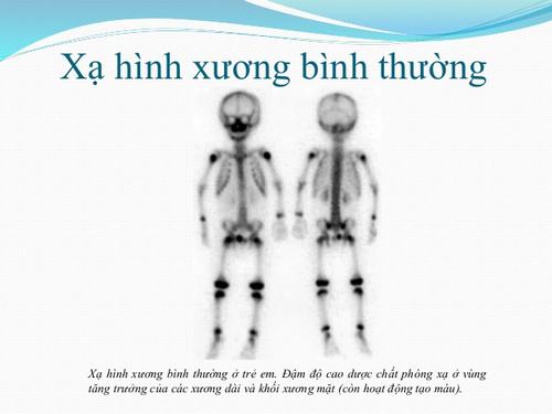 Xạ hình xương là gì? Quy trình, lợi ích và các ứng dụng y học