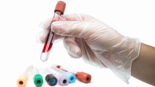 Xét nghiệm máu cũng được sử dụng để tìm vi khuẩn HP nhưng hiệu quả không cao nên ít được sử dụng