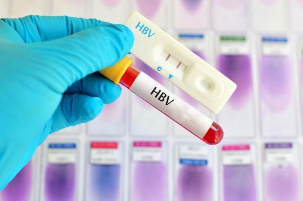 Xét nghiệm viêm gan B là các xét nghiệm máu cho biết bạn có bị nhiễm vi rút viêm gan B hay không
