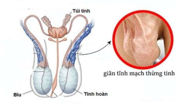 Các phương pháp chẩn đoán và điều trị