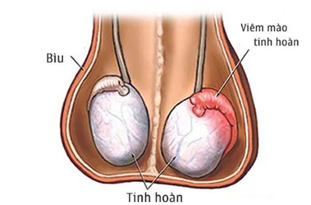 Các Phương Pháp Điều Trị