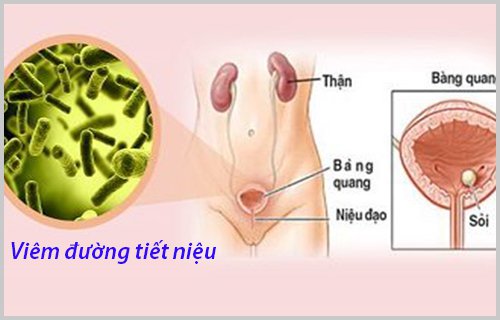 chi phi tan soi than ngoai co the 2