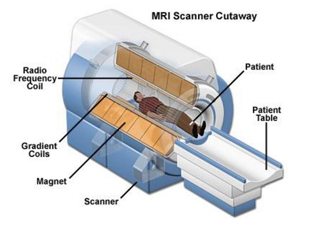 Chụp cộng hưởng từ là phương pháp chẩn đoán hình ảnh chính xác, an toàn nhờ sóng từ trường và radio