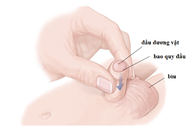 Tùy vào tình trạng bệnh của trẻ, từ đó bác sĩ sẽ đưa ra phác đồ điều trị hiệu quả và an toàn. 