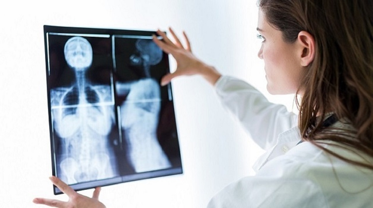 Chụp x quang phổi liệu có cần phải cởi áo hay không?