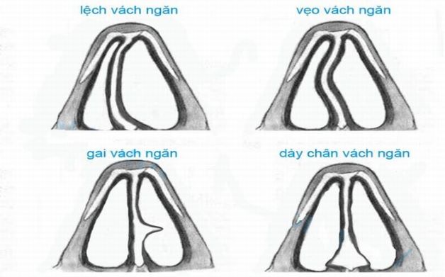 4. Giải Pháp Điều Trị