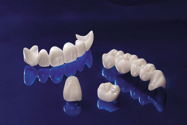 Răng sứ Cercon HT  là loại răng sứ cao cấp có màu sắc tự nhiên và độ bền cao