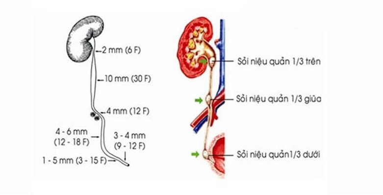 soi nieu quan 1 phan 3 giua 2