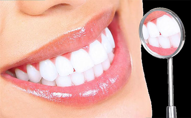 Tẩy trắng răng có đau không và những lưu ý kèm theo