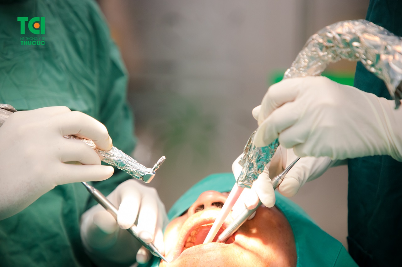 Thực hiện trồng răng Implant cho khách hàng tại BV ĐKQT Thu Cúc