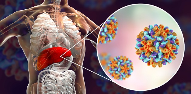Viêm gan siêu vi B mạn là gì?